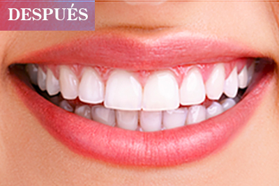 Clinica 3S Salud Sonrisa Satisfacción
